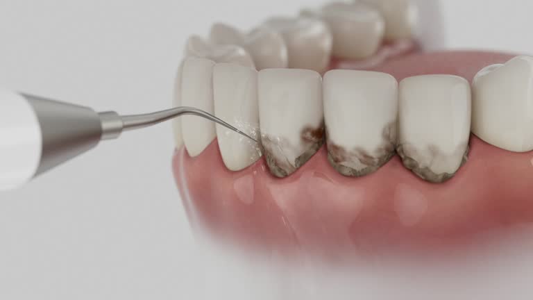Trusted Dental Implants service in Marina, CA - Dentist Open Now